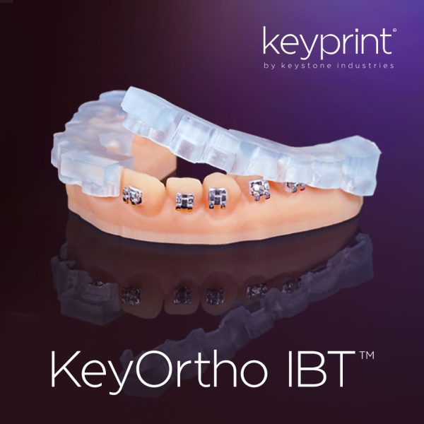 Keystone Key Ortho IBT