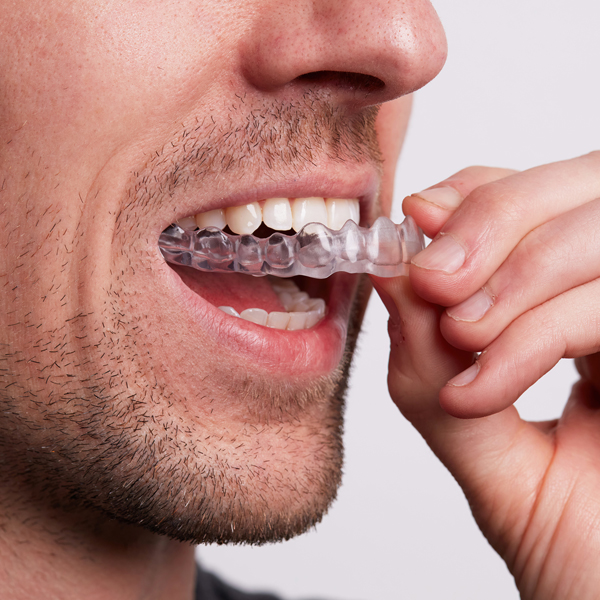 Formlabs Dental LT Comfort Resin (Form 4)