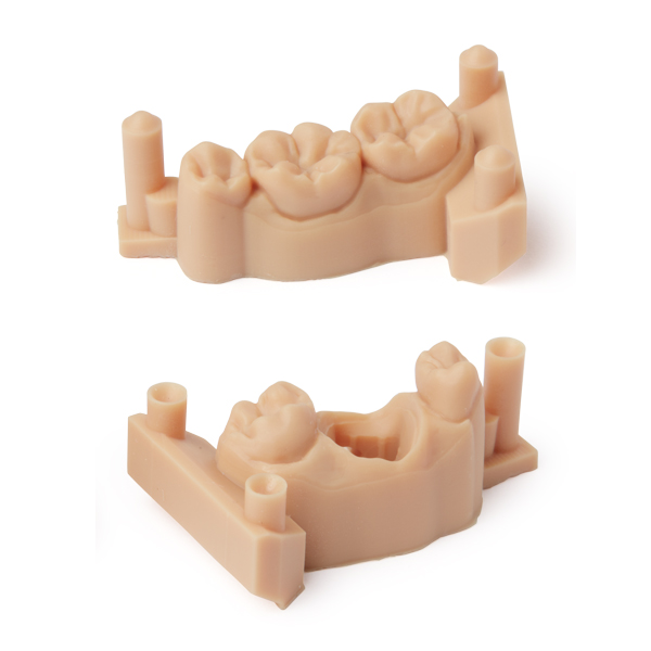Formlabs Model Resin V2 – Präzisionsharz für dentale Modellherstellung (nur Form 3/B)